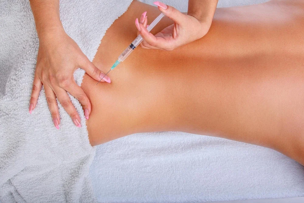 Bölgesel Zayıflama İçin Mezoterapi (Lipoliz): İnatçı Yağlara Ameliyatsız Çözüm