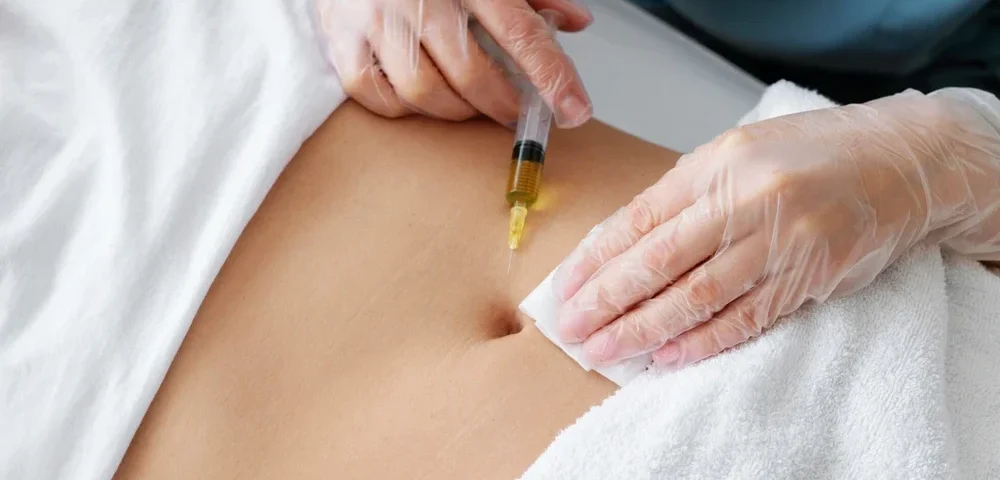 Çatlak Tedavisinde Mezoterapi Kullanımı: Cildinize Onarım Desteği