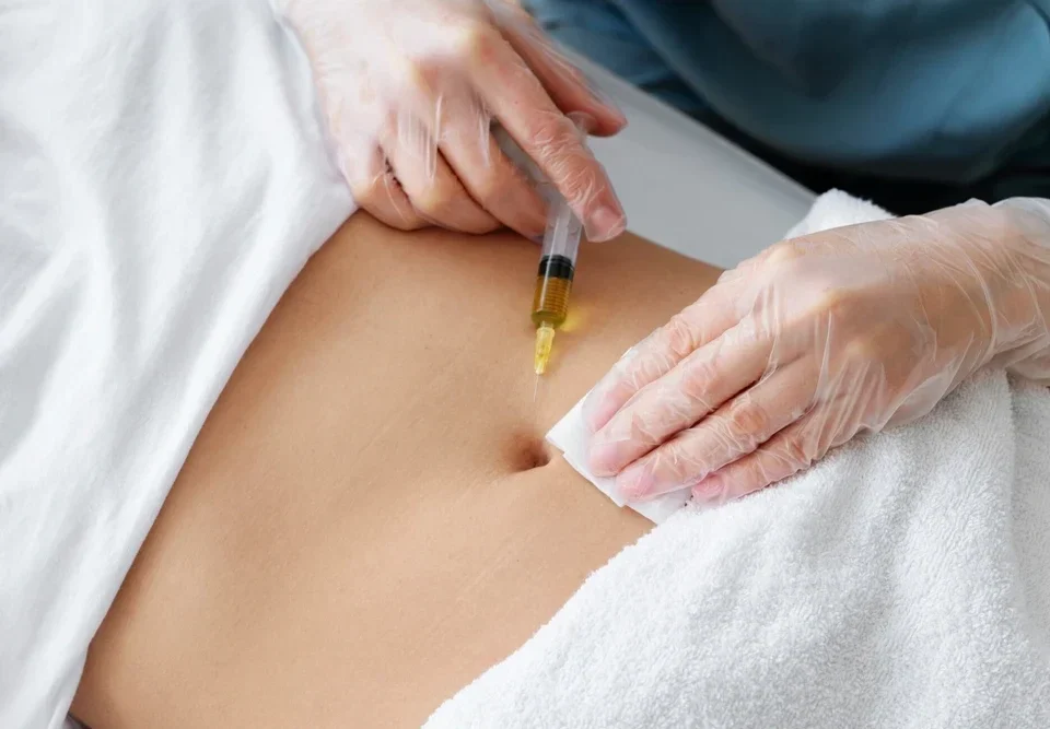 Çatlak Tedavisinde Mezoterapi Kullanımı: Cildinize Onarım Desteği