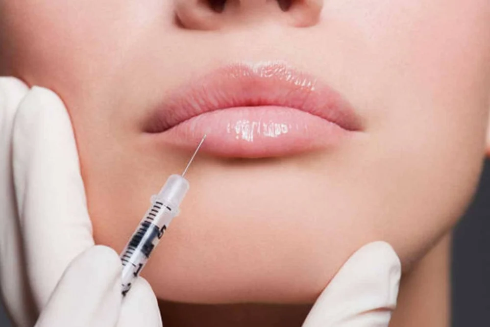 Dudak & Jawline Dolgusu | Dr. Melis Ülger | İstanbul