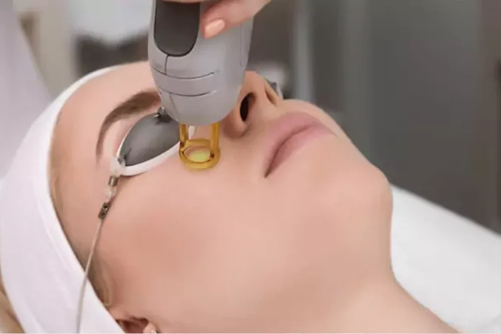Lazerle Leke Tedavisi | Dr. Melis Ülger | İstanbul
