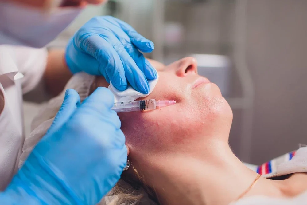 Dolgu Sonrası Şişlik ve Morluk: Normal mi ve Nasıl Geçer?