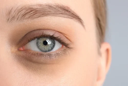 Which Application is Effective for Dark Circles Under the Eyes? | Dr. Melis Ülger