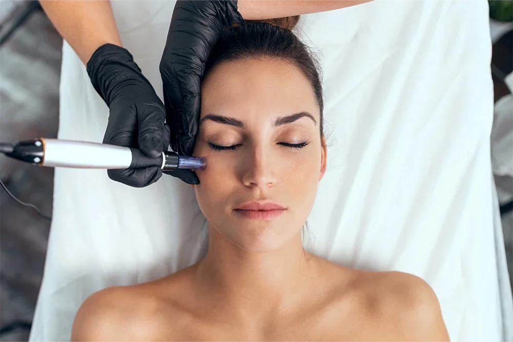 What is Mesotherapy? Application and Benefits in Istanbul | Dr. Melis Ulger