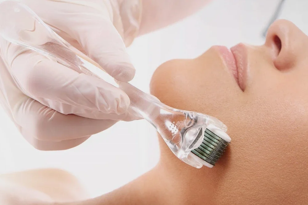 What is Mesotherapy? Application and Benefits in Istanbul | Dr. Melis Ulger
