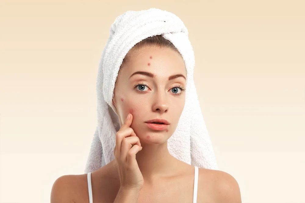 How to Remove Skin Blemishes? Mesotherapy and Other Solutions