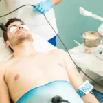 Erkekler İçin Lazer Epilasyon: En Çok Tercih Edilen Bölgeler 10 Erkekler İçin Lazer Epilasyon | Kadıköy Dr. Melis Ülger