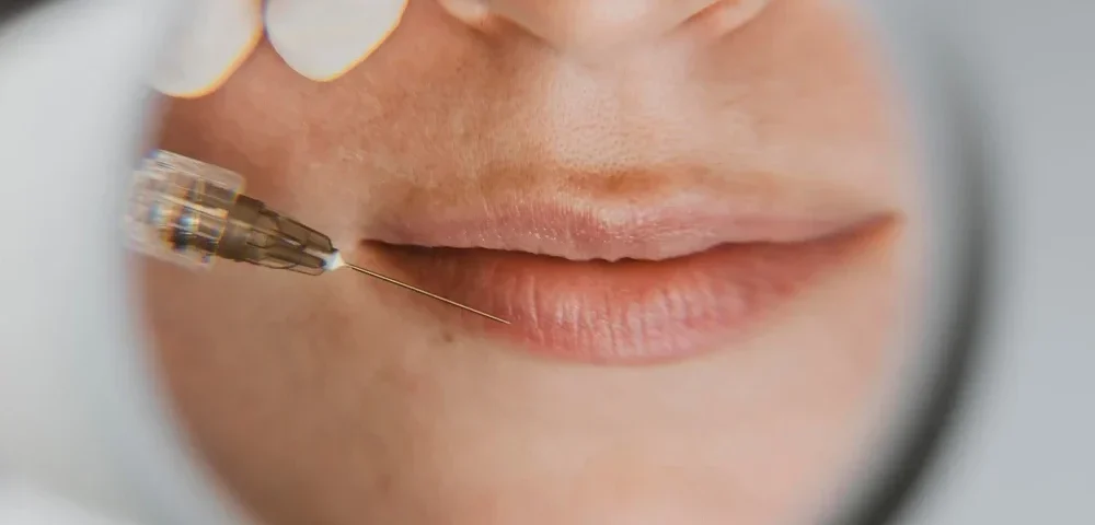 Medikal Estetik Yaptırmadan Önce Bilmeniz Gereken 10 Temel Şey 14 Medikal Estetik Öncesi Bilmeniz Gereken 10 Şey | Dr. Ülger