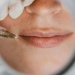 Medikal Estetik Öncesi Bilmeniz Gereken 10 Şey | Dr. Ülger