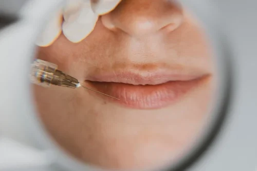 Medikal Estetik Öncesi Bilmeniz Gereken 10 Şey | Dr. Ülger