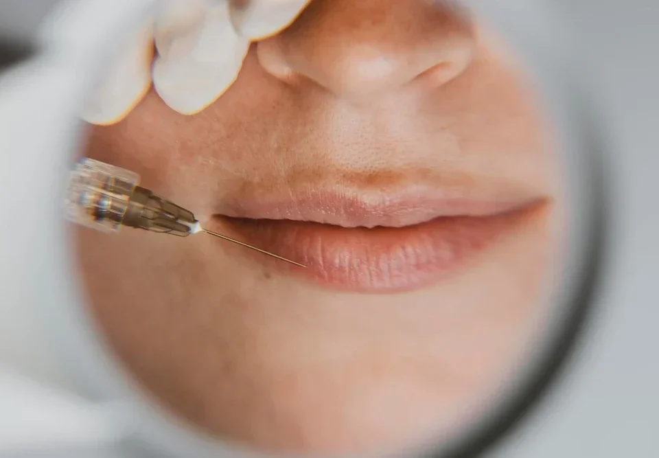 Medikal Estetik Öncesi Bilmeniz Gereken 10 Şey | Dr. Ülger