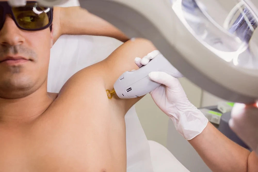 Erkekler İçin Lazer Epilasyon | Kadıköy Dr. Melis Ülger