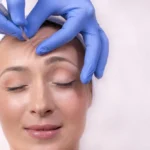 Alın Botoksu: Kırışıklıklara Veda Edin