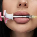 Dudak Dolgusu Hakkında Her Şey: Doğal ve Çekici Dudaklar