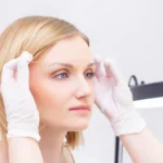 Kaş Arası Botoksu: Çatık Kaş İfadesinden Kurtulun, Daha Yumuşak Bir Görünüm Kazanın 9 Kaş Arası Botoksu: Çatık Kaş İfadesinden Kurtulun, Daha Yumuşak Bir Görünüm Kazanın