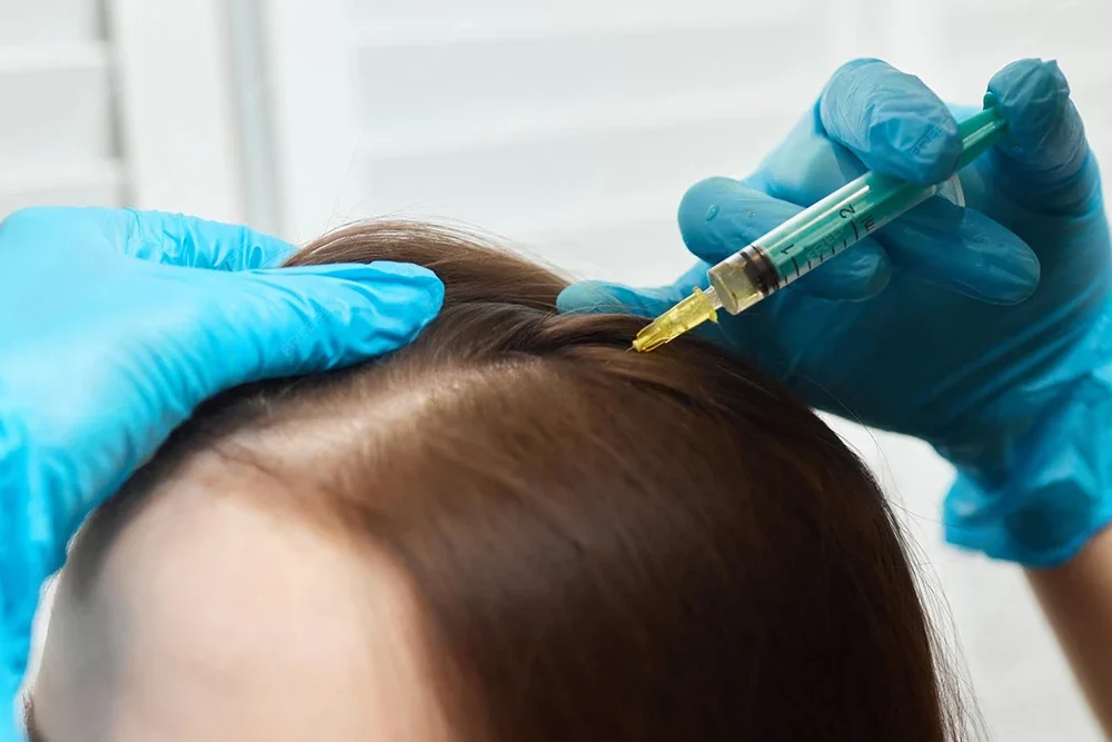 Mezoterapi ve PRP Tedavisi: Cildiniz İçin Hangisi Daha Etkili?