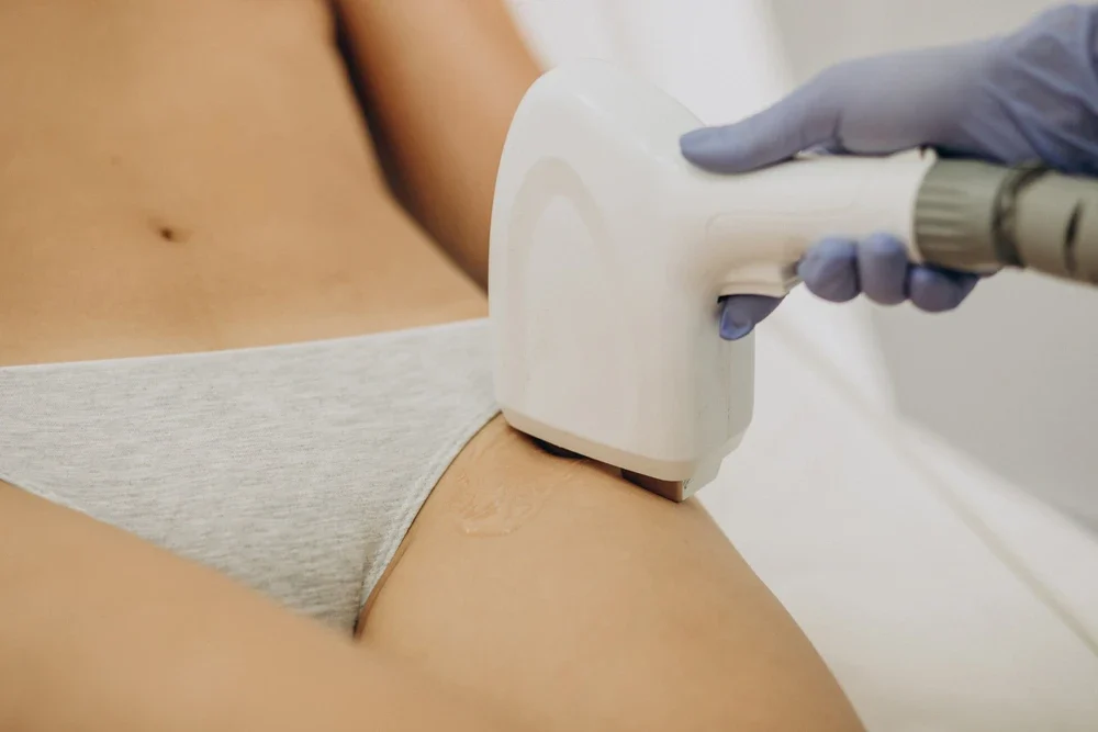 Genital Bölge Lazer Epilasyon: Hijyen, Konfor ve Dikkat Edilmesi Gerekenler