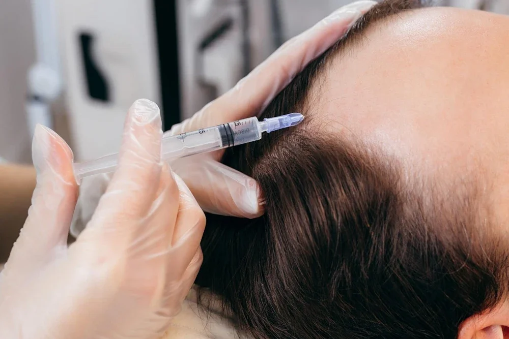 Mezoterapi ve PRP Tedavisi: Cildiniz İçin Hangisi Daha Etkili?