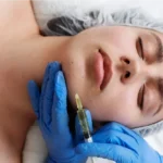 Scarlet X (Altın İğne) Nedir? Ameliyatsız Cilt Gençleştirme Rehberi 8 What is Scarlet X (Golden Needle)? Non-Surgical Skin Rejuvenation Guide