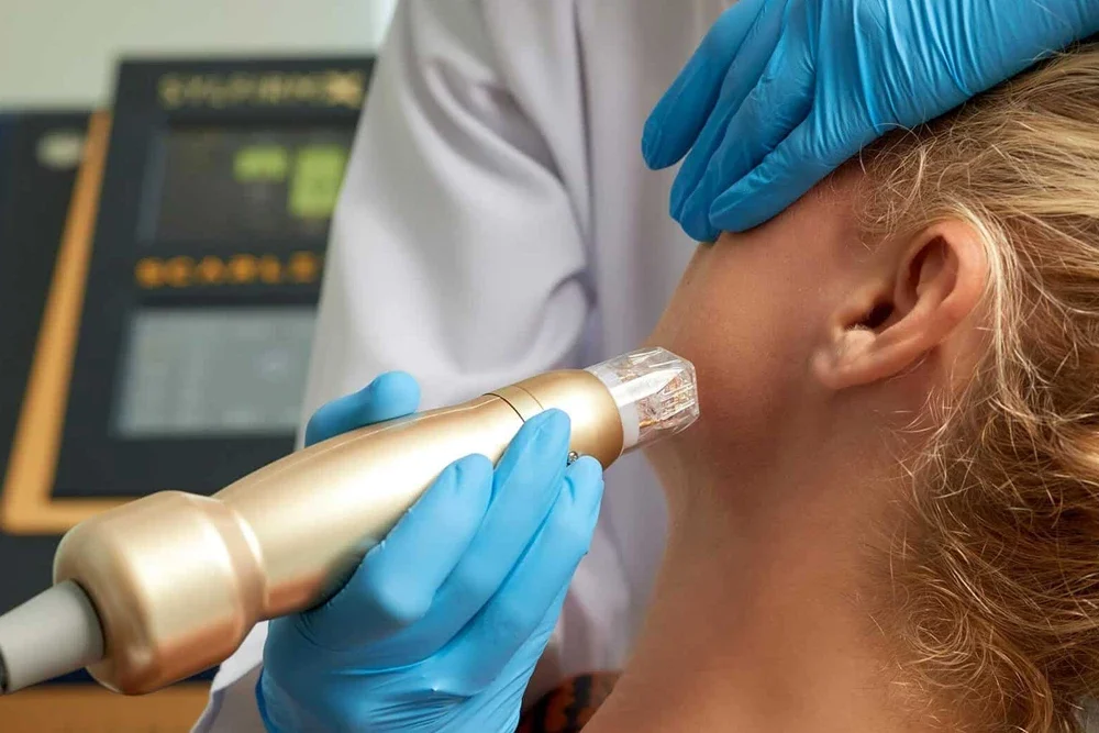 Scarlet X (Altın İğne)