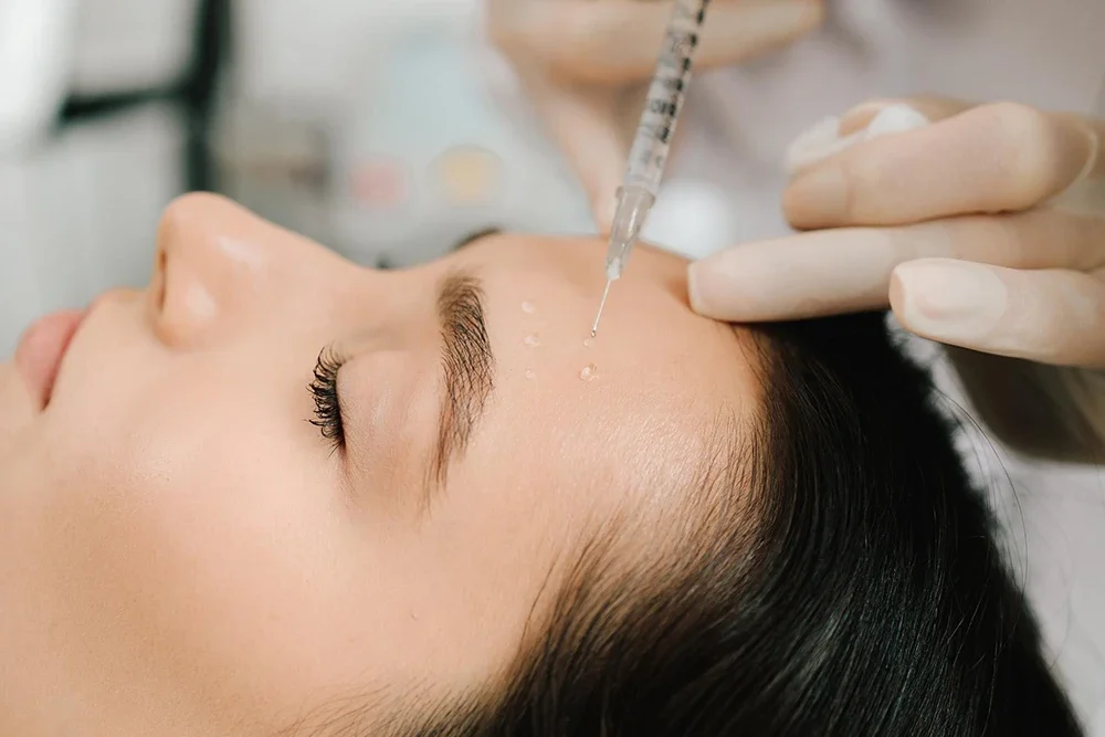 Is It Possible to Improve Skin Quality with Dermal Fillers? The Miracle Beyond Volume
