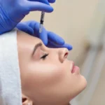 Botoksun Etkisi Ne Zaman Başlar ve Ne Kadar Sürer?