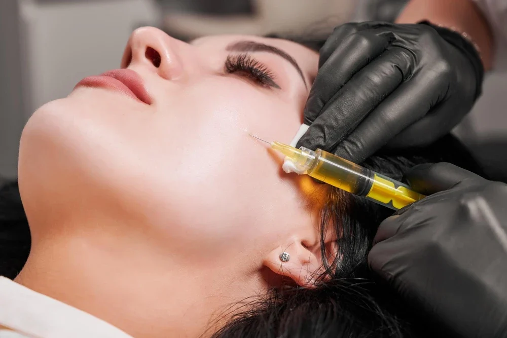 Dolgu Eritme İşlemi Nedir? Hyaluronidaz ile Hatalı Dolgulara Veda