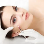 Botoks Yaptırdıktan Sonra Kaç Günde Oturur? Sonuçları Görme Takvimi