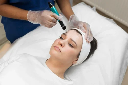 Hydrafacial ile Ciltteki Yağlanma Sorununa Çözüm: Parlamadan Arınmış, Sağlıklı Bir Cilt