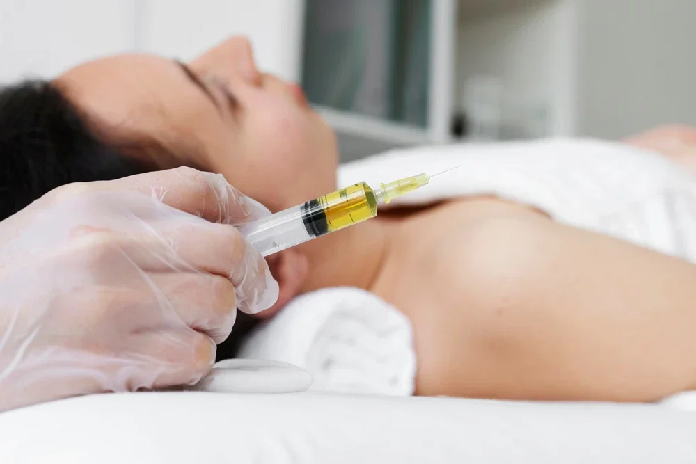 Dolgu Eritme İşlemi Nedir? Hyaluronidaz ile Hatalı Dolgulara Veda