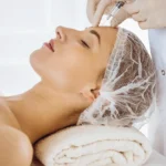 Medikal Estetik ile Kılcal Damar Tedavisi: Yüzünüzdeki Kırmızı Haritayı Silin 9 Medikal Estetik ile Kılcal Damar Tedavisi: Yüzünüzdeki Kırmızı Haritayı Silin