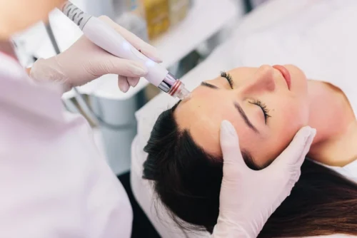 Hydrafacial ile Cilt Lekeleri Tedavisi: Pürüzsüz ve Eşit Bir Ton