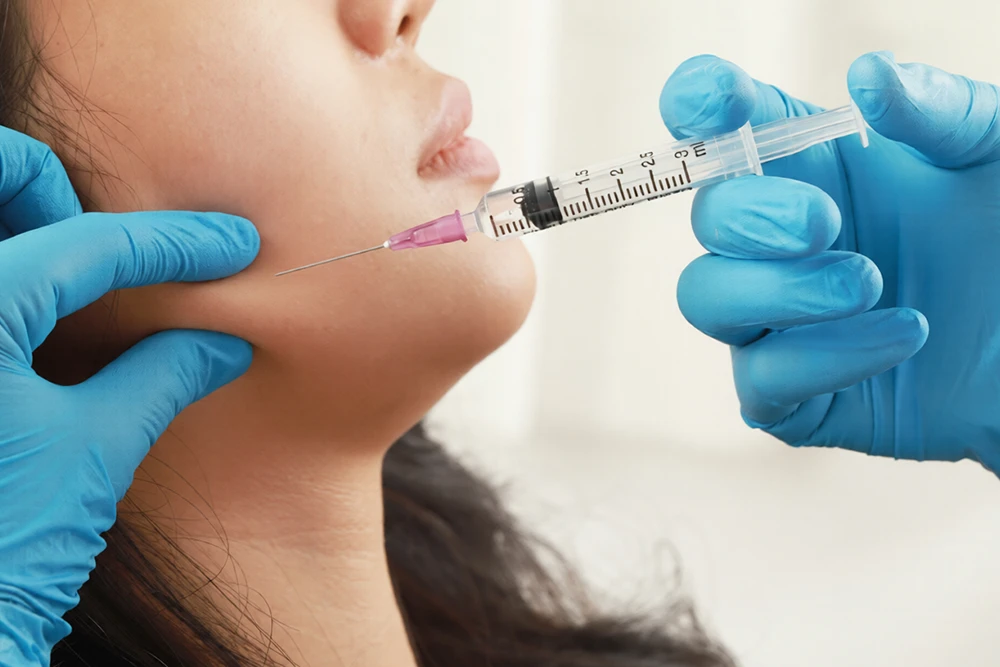 Dermal Dolgu ile Yüz Germe Etkisi Yaratmak (Sıvı Yüz Germe): Ameliyatsız Gençleşme