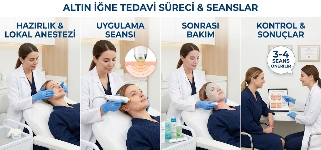 What is Golden Needle? Treatment, Scarlet X and Skin Renewal 8 What is gold needle and radiofrequency skin rejuvenation with Dr. Melis Ülger