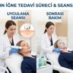 Altın İğne Nedir? Tedavi, Scarlet X ve Cilt Yenileme 4 What is gold needle and radiofrequency skin rejuvenation with Dr. Melis Ülger