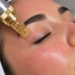 Gold Needle Benefits: 7 Changes in Skin
