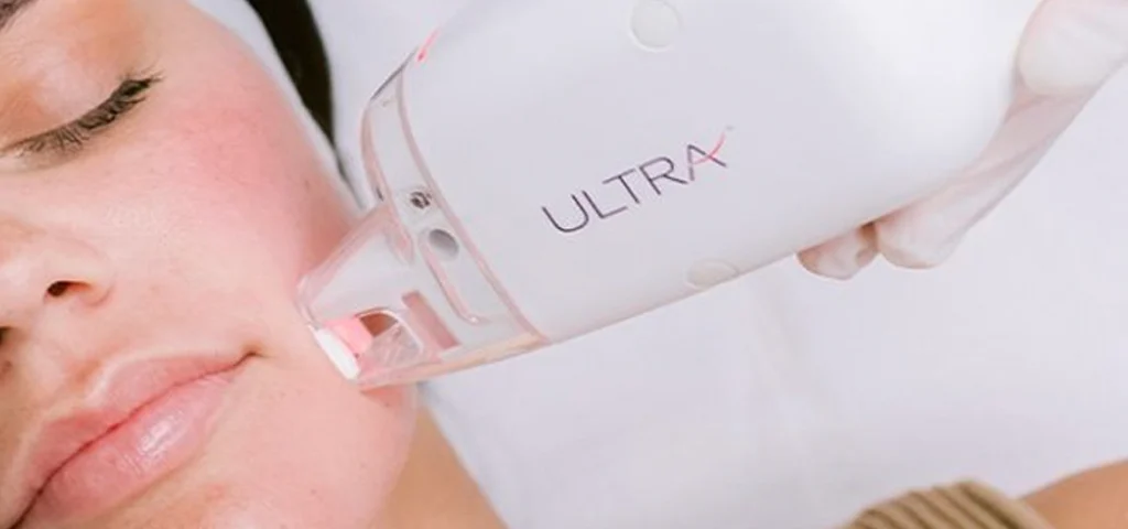 Baby Face Laser: Smooth Skin in 5 Steps
