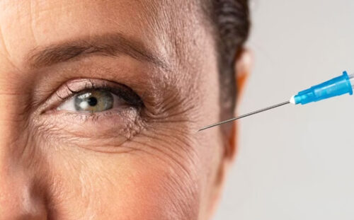 Botox for the Eye Area: Benefits and Risks in 2026