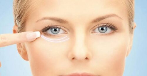 Under-Eye Mesotherapy: The 2026 Guide to Dark Circles and Radiance