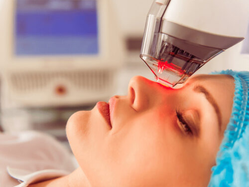 Laser Spot Treatment: Is It Safe and Effective in 2026?