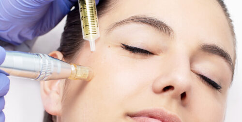 2026 Mesotherapy Prices: Factors Affecting the Cost