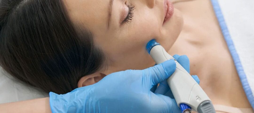 Hydrafacial Blackhead Removal: The 2026 Guide