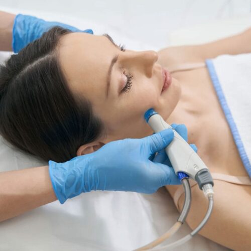 Hydrafacial Blackhead Removal: The 2026 Guide