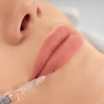 Lip Filler Infection: 7 Symptoms and Solutions (2026) 6 Lip Filler Infection: 7 Symptoms and Solutions (2026)