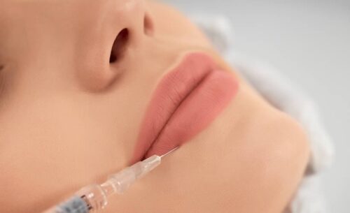 Lip Filler Infection: 7 Symptoms and Solutions (2026)
