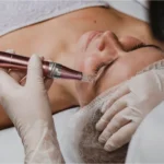 What Is Needle-Free Mesotherapy? A 2026 Guide to Its Effects