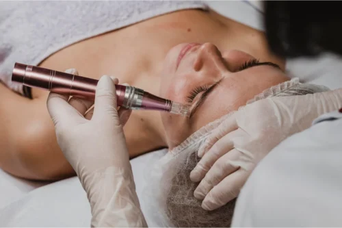 What Is Needle-Free Mesotherapy? A 2026 Guide to Its Effects