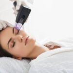 Radiofrequency Skin Treatment: The 2026 Guide to Skin Tightening
